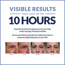 Load image into Gallery viewer, Plexaderm Rapid Reduction Eye Serum, Advanced Formula - Anti Aging Serum Visibly Reduces Under-Eye Bags, Wrinkles, Dark Circles, Fine Lines &amp; Crow&#39;s Feet Instantly - Instant Wrinkle Remover for Face