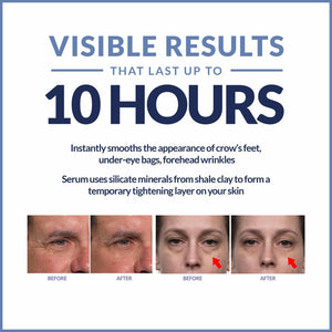 Plexaderm Rapid Reduction Eye Serum, Advanced Formula - Anti Aging Serum Visibly Reduces Under-Eye Bags, Wrinkles, Dark Circles, Fine Lines & Crow's Feet Instantly - Instant Wrinkle Remover for Face