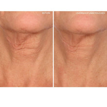 Load image into Gallery viewer, SiO Beauty NeckLift | Neckline Anti-Wrinkle Patch | Overnight Smoothing Silicone Patches For Neck Wrinkles, Fine Lines And Turkey Neck