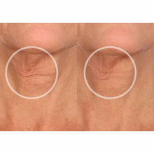 Load image into Gallery viewer, SiO Beauty NeckLift | Neckline Anti-Wrinkle Patch | Overnight Smoothing Silicone Patches For Neck Wrinkles, Fine Lines And Turkey Neck