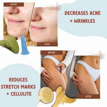 Load image into Gallery viewer, 7-Piece Lymphatic Drainage Kit with E-Book: Premium Wooden, Jade &amp; Silicone Massage Tools | Maderoterapia, Dry Brushing, Cupping &amp; Guasha Tool Kit for Body Sculpting, Cellulite, Acne &amp; Fascia Relief