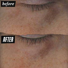 Load image into Gallery viewer, Kiehl&#39;s Dermatologist Solutions Powerful-Strength Line-Reducing &amp; Dark Circle-Diminishing Vitamin C Eye Serum 15ml/0.5oz