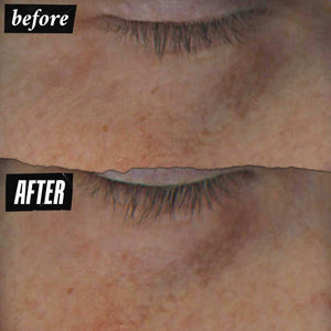 Kiehl's Dermatologist Solutions Powerful-Strength Line-Reducing & Dark Circle-Diminishing Vitamin C Eye Serum 15ml/0.5oz